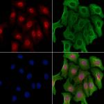 NIPA Polyclonal Antibody