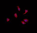 OCT6 Polyclonal Antibody