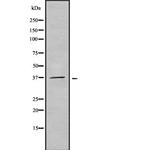 OR51F2 Polyclonal Antibody