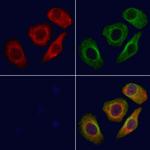 OR5AP2 Polyclonal Antibody