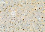 PEG3 Antibody in Immunohistochemistry (Paraffin) (IHC (P))