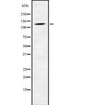 PHKB Polyclonal Antibody