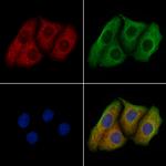 PXMP4 Antibody in Immunocytochemistry (ICC/IF)