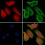 RhoBTB3 Polyclonal Antibody