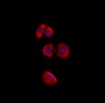 RPS2 Polyclonal Antibody