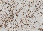 SIN3B Antibody in Immunohistochemistry (Paraffin) (IHC (P))