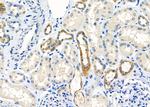STAM2 Polyclonal Antibody