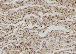 ZNF280A Polyclonal Antibody