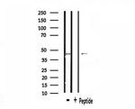 SS18 Polyclonal Antibody