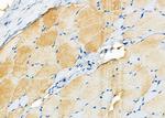 TAUT Polyclonal Antibody