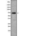 TAUT Antibody in Western Blot (WB)