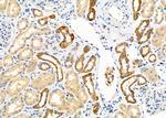 TBL2 Polyclonal Antibody