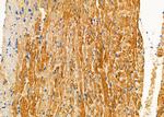 TBL2 Antibody in Immunohistochemistry (Paraffin) (IHC (P))