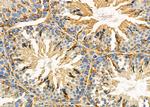 TBL2 Antibody in Immunohistochemistry (Paraffin) (IHC (P))