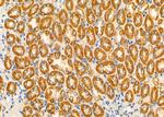 TBL2 Antibody in Immunohistochemistry (Paraffin) (IHC (P))