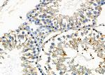 TBL2 Antibody in Immunohistochemistry (Paraffin) (IHC (P))