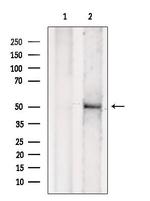 TBL2 Antibody in Western Blot (WB)