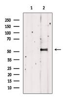 TDE1 Polyclonal Antibody