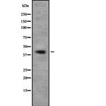 TOB1 Polyclonal Antibody