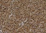UBE3B Polyclonal Antibody