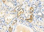 USP40 Polyclonal Antibody