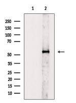 V-ATPase H Polyclonal Antibody