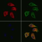 WAVE1 Polyclonal Antibody