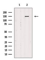 YEATS2 Polyclonal Antibody