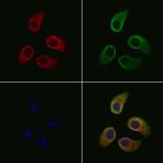 SLC39A2 Polyclonal Antibody