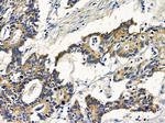 SLC39A2 Antibody in Immunohistochemistry (Paraffin) (IHC (P))