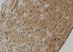 ZMYM4 Antibody in Immunohistochemistry (Paraffin) (IHC (P))