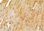ZMYM4 Polyclonal Antibody