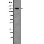 ZNF608 Antibody in Western Blot (WB)