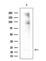 UBE2E3 Polyclonal Antibody