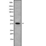 UBE2U Polyclonal Antibody