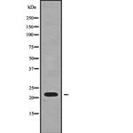 SFT2D3 Antibody in Western Blot (WB)