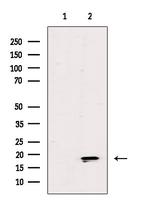 ZNHIT1 Polyclonal Antibody