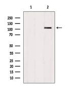 ZNF295 Polyclonal Antibody