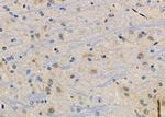 ZNF462 Polyclonal Antibody