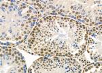 ZNF600 Antibody in Immunohistochemistry (Paraffin) (IHC (P))