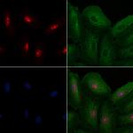 CDC2L5 Antibody in Immunocytochemistry (ICC/IF)