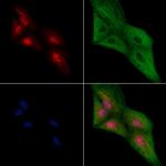 CDC2L5 Polyclonal Antibody