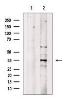 MAGEA3 Polyclonal Antibody
