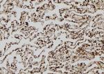 MAGEA8 Polyclonal Antibody