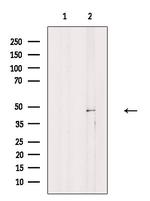 MAGEA11 Polyclonal Antibody