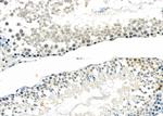 MAGEB3 Polyclonal Antibody