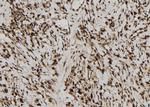 MAGEB10 Polyclonal Antibody