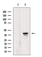 MAGEB10 Antibody in Western Blot (WB)