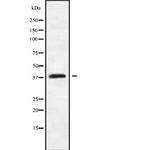 MAGEB18 Polyclonal Antibody
