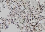 MAGED2 Polyclonal Antibody